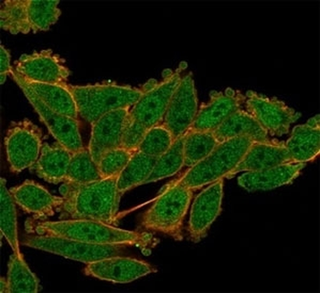 Serum Response Factor Antibody / SRF
