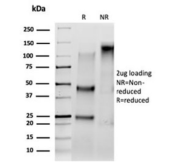 Serum Response Factor Antibody / SRF