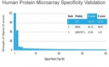 Serum Response Factor Antibody / SRF