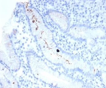 Helicobacter pylori Antibody (Catalase)
