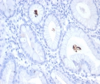 Helicobacter pylori Antibody (Catalase)
