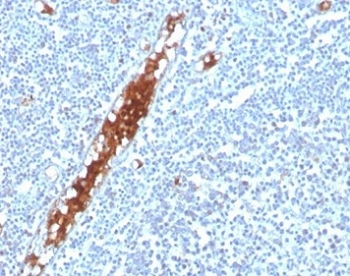 SPARC Antibody / Osteonectin