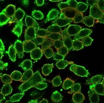 MED22 Antibody