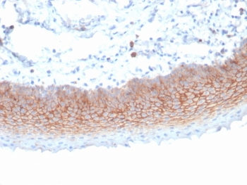 Syndecan-1 Antibody / CD138