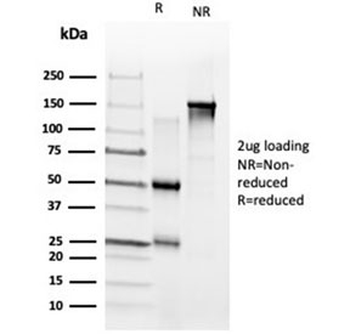 ZNF704 Antibody / Gig1