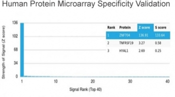ZNF704 Antibody / Gig1