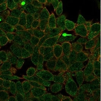 ZNF704 Antibody / Gig1