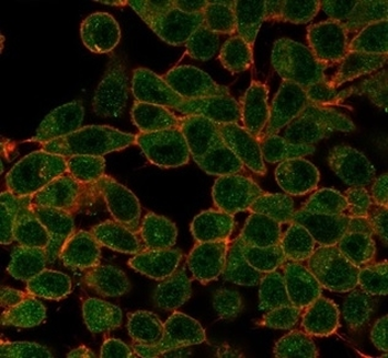 SRF Antibody / Serum Response Factor
