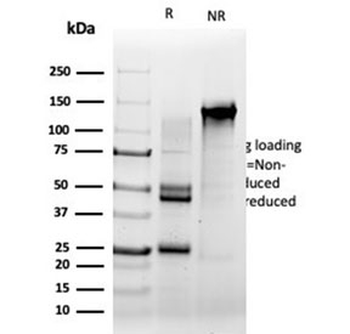 SRF Antibody / Serum Response Factor