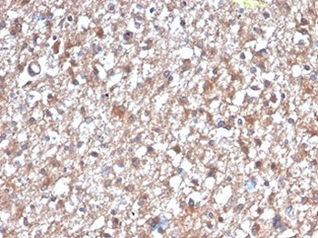 PKC iota Antibody / PRKCI