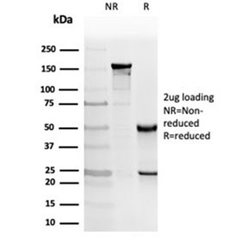 PKC iota Antibody / PRKCI