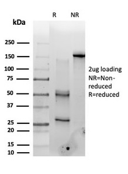 PMS1 Antibody / PMS1 protein homolog 1