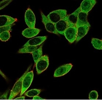 PMS1 Antibody / PMS1 protein homolog 1