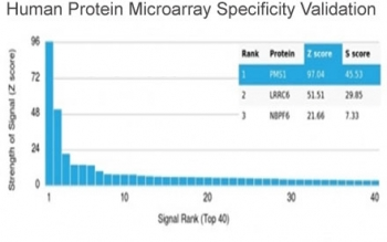 PMS1 Antibody / PMS1 protein homolog 1