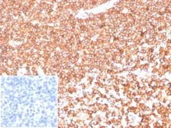 Beta Actin Antibody / ACTB