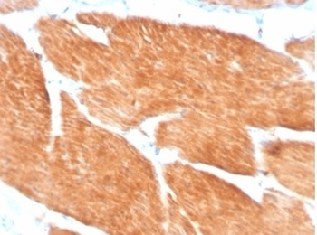 PIK3R2 / PI3K Antibody (p85 beta)