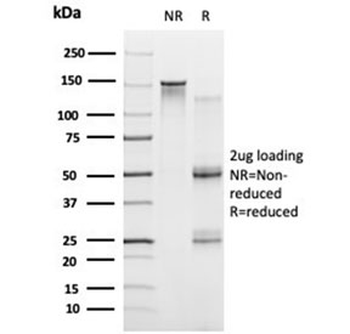 PRMT7 Antibody