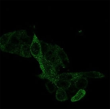 PRMT7 Antibody