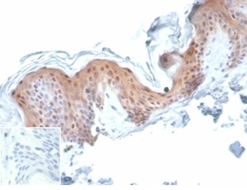 MASPIN Antibody / SERPINB5