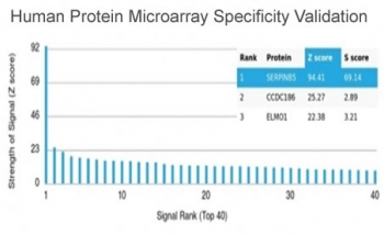 MASPIN Antibody / SERPINB5