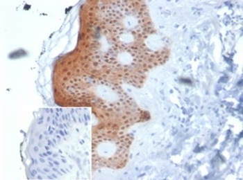MASPIN Antibody / SERPINB5