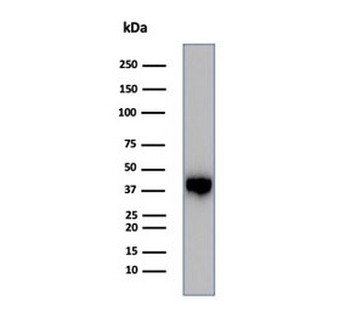 MASPIN Antibody / SERPINB5