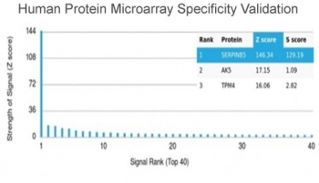 MASPIN Antibody / SERPINB5