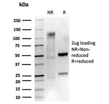NGFR/TNFRSF16 Antibody / p75NTR / CD271