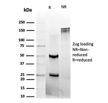 L-Myc Antibody / MYCL1