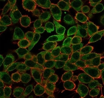 L-Myc Antibody / MYCL1