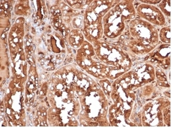 MICA Antibody