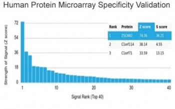 ZSCAN2 Antibody