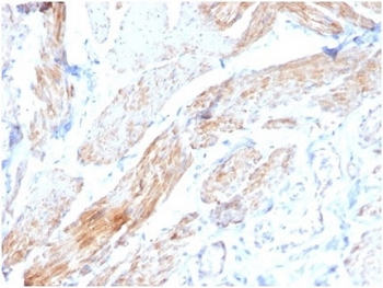 Phosphoglucomutase 5 Antibody / PGM5 / Aciculin