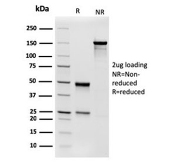 Phosphoglucomutase 5 Antibody / PGM5 / Aciculin