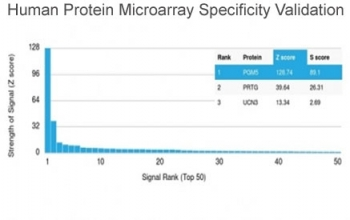 Phosphoglucomutase 5 Antibody / PGM5 / Aciculin