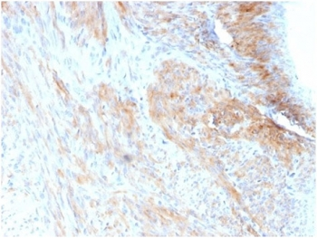 Phosphoglucomutase 5 Antibody / PGM5 / Aciculin