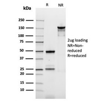 Recombinant Ornithine Decarboxylase Antibody / ODC1