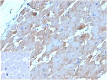 BNP Antibody / Brain Natriuretic Peptide / NPPB