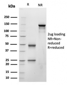 BNP Antibody / Brain Natriuretic Peptide / NPPB