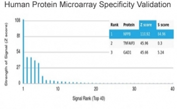 BNP Antibody / Brain Natriuretic Peptide / NPPB