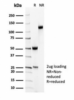 Recombinant SMMHC Antibody / Smooth Muscle Myosin Heavy Chain