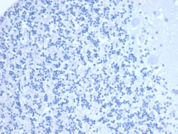 Neprilysin Antibody / CD10