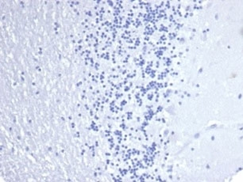 Keratin 14 Antibody / Cytokeratin 14 / KRT14