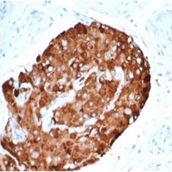 Recombinant INHA Antibody / Inhibin alpha