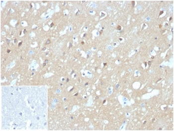 Aquaporin 4 Antibody / AQP4