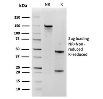 Aquaporin 4 Antibody / AQP4