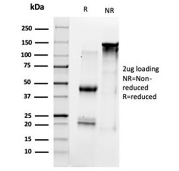 HDAC1 Antibody