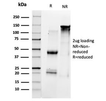 TFIIB Antibody / GTF2B