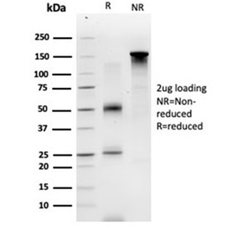 GTF2A1 Antibody / TFIIA