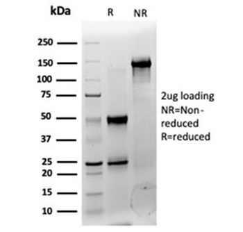 CNOT10 Antibody / CCR4-NOT transcription complex subunit 10
